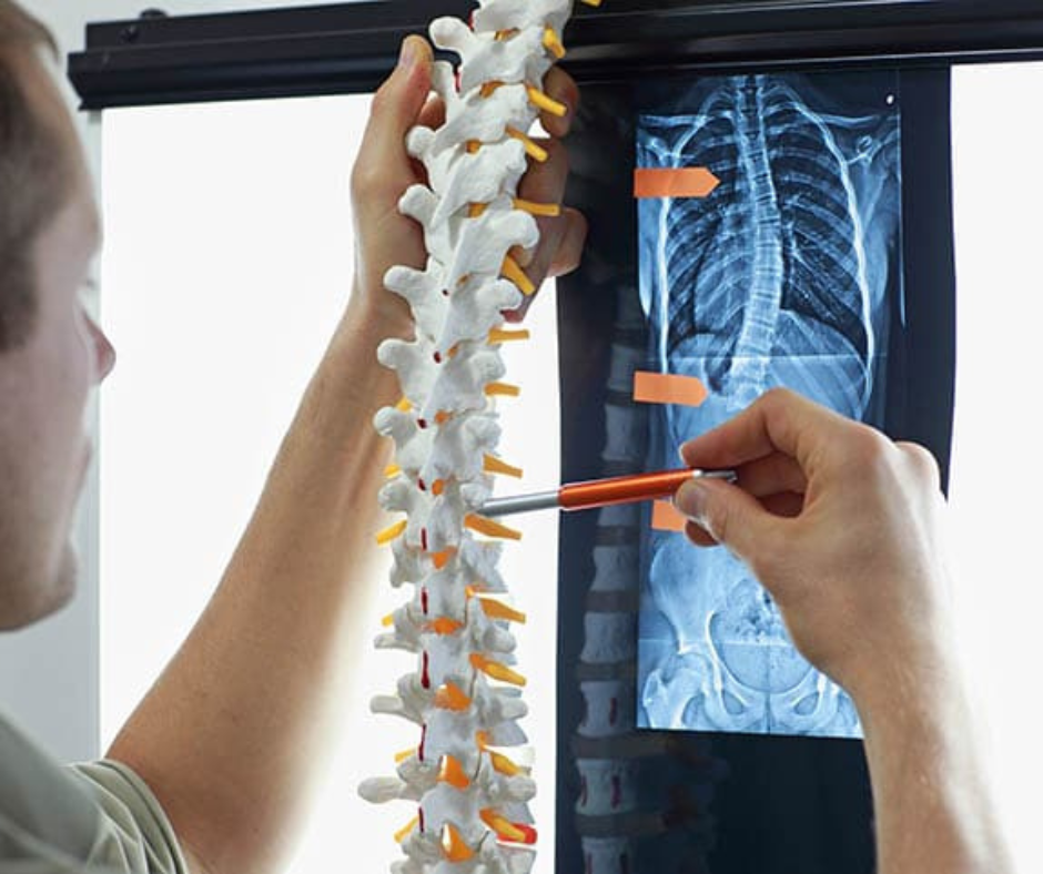 spinal cord injuries